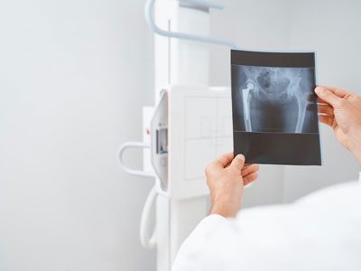 Radiology-X-Ray Radiology-X-Ray